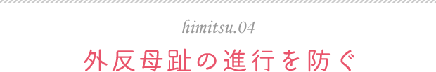 himitsu.04 外反母趾の進行を防ぐ